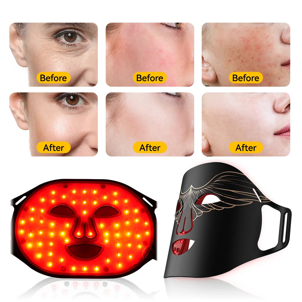 Photon LED Therapy Beauty Mask